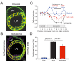 Capillary pericytes mediate coronary no-reflow after myocardial ischaemia
