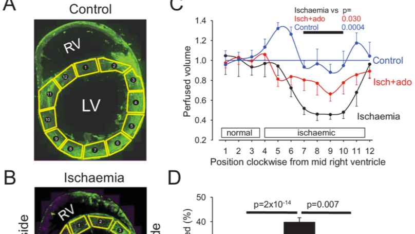 Capillary pericytes mediate coronary no-reflow after myocardial ischaemia