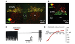 Cardioprotection evoked by remote ischaemic preconditioning is critically dependent on the activity of vagal pre-ganglionic neurones